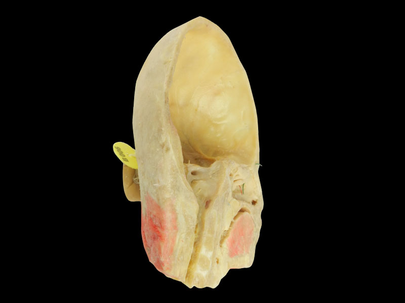 Paranasal sinuses and its opening plastination