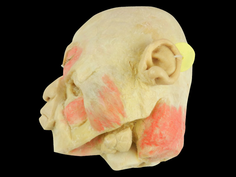 Paranasal sinuses and its opening specimen
