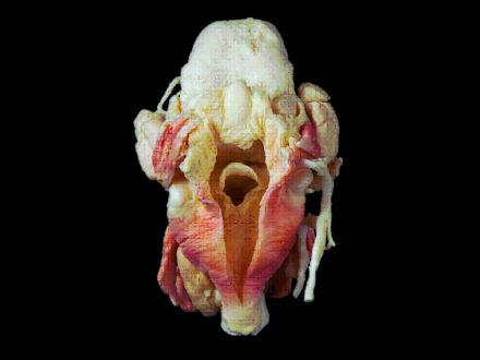 Pharynx and larynx plastinated specimens(plastination process  )