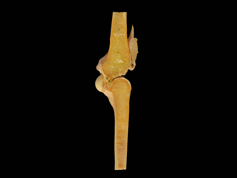 saggital section of keen joint plastinated specimen