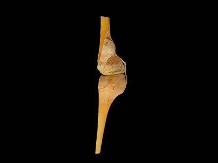 saggital section of keen joint plastinated specimen