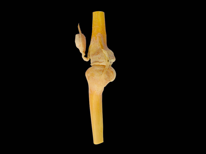 saggital section of keen joint