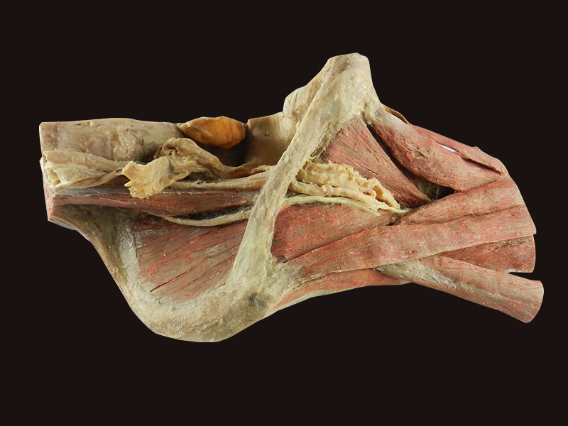 Sagittal section of female pelvis with uterus vessels specimen