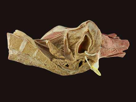 sagittal section of female pelvis with uterus vessels specimen