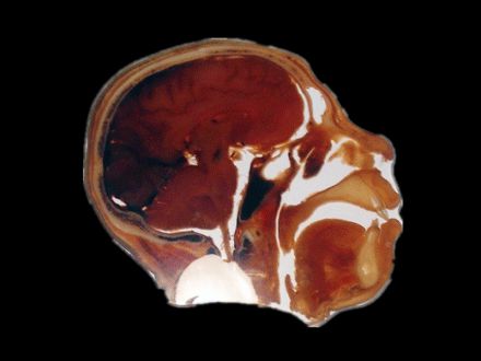 Sagittal section of head slice embedded slice