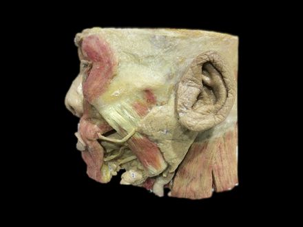 Salivary gland plastinated specimens (plastinated specimen for sale) 