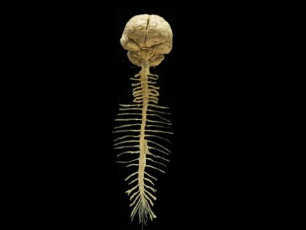 Brain and spinal cord specimens plastinated specimens