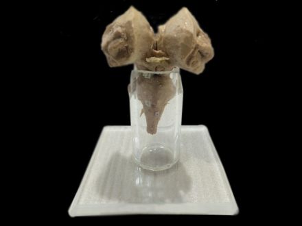 Brainstem plastinated specimens