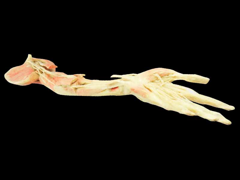 Deep vascular nerve of upper limb plastination