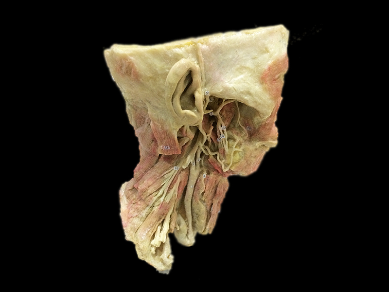 Head and Neck deep neurovascular plastinated specimens 