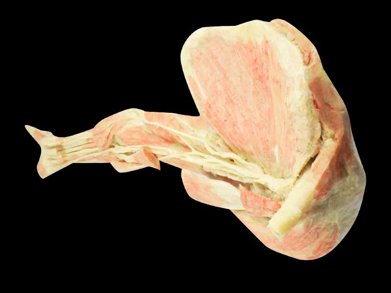 Human deep vascular nerve of upper limb plastination