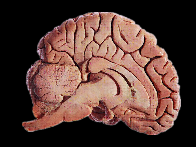 Median sagittal section of the brain embedded slice