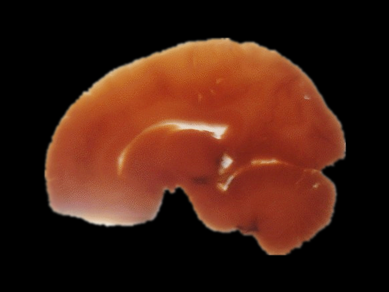 Sagittal section of brain embedded slice