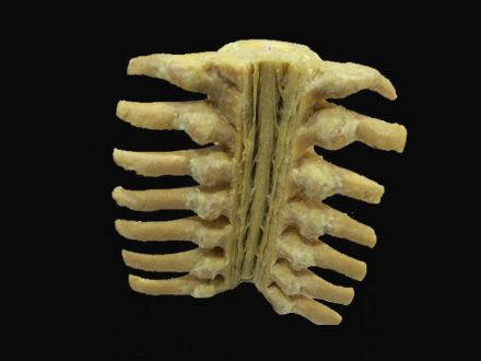 Spinal cord capsule plastinated specimens