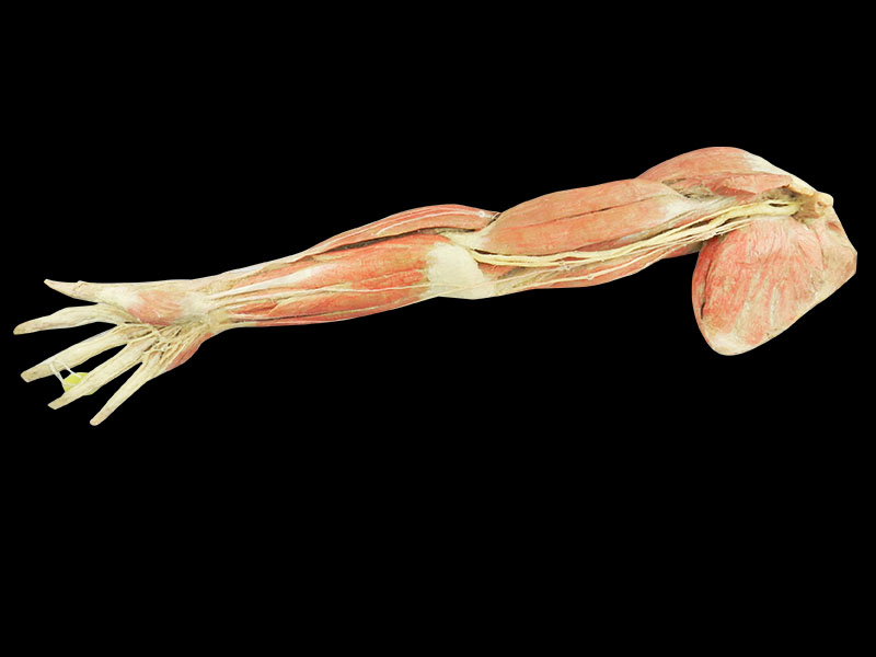 Superficial blood vessels and nerves of upper limb plastinated specimen