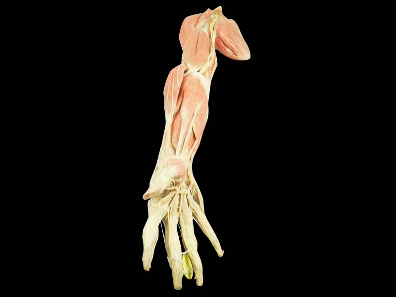 Superficial blood vessels and nerves of upper limb plastination