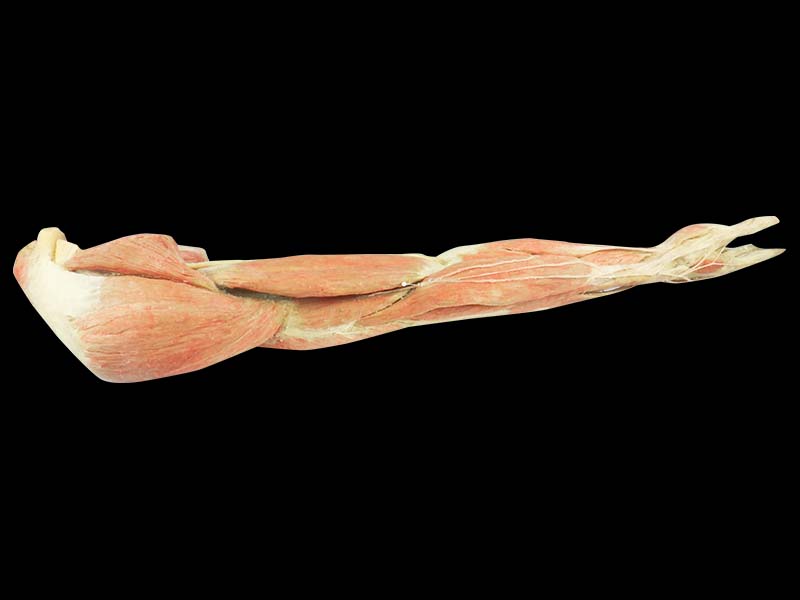 Superficial blood vessels and nerves of upper limb specimen