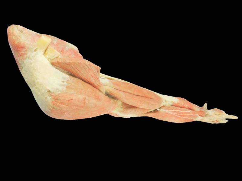 Superficial blood vessels and nerves of upper limb teaching specimen