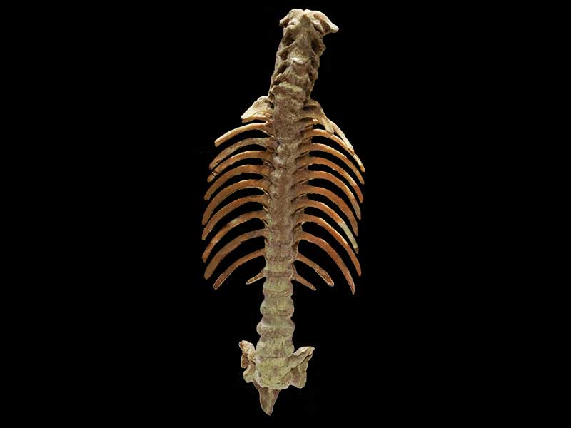 spinal cord plastination