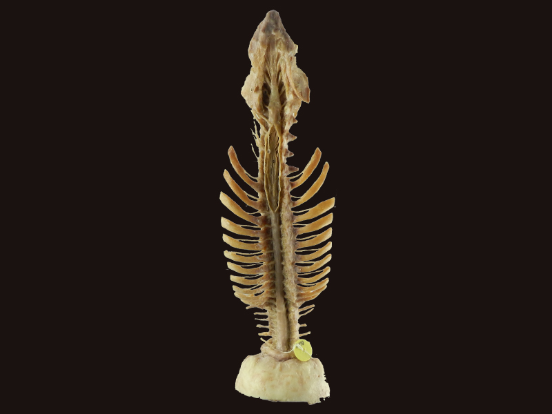 Spinal cord with nerves in vertebral column