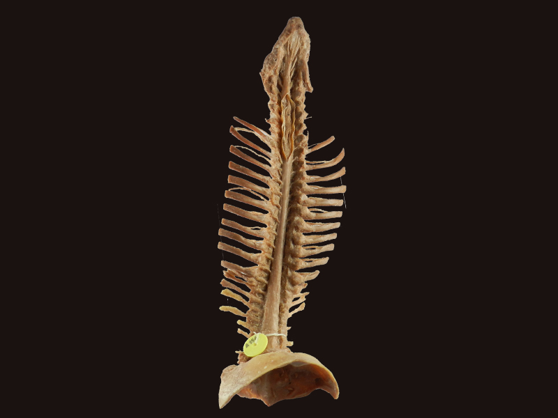 Spinal cord with nerves in vertebral column plastination