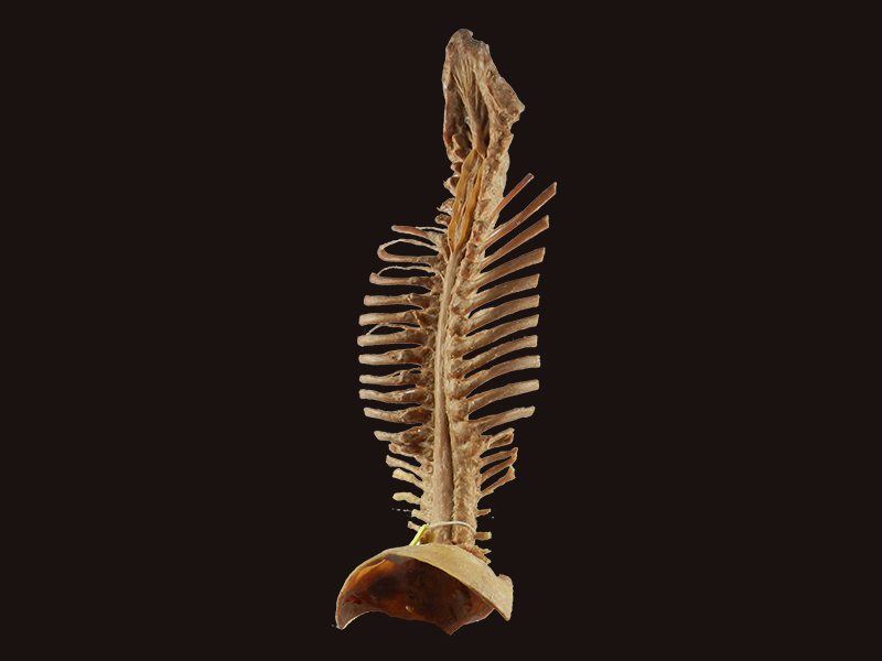 Spinal cord with nerves in vertebral column specimen