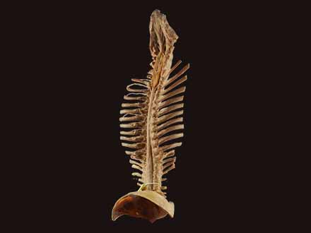 Spinal cord with nerves in vertebral column