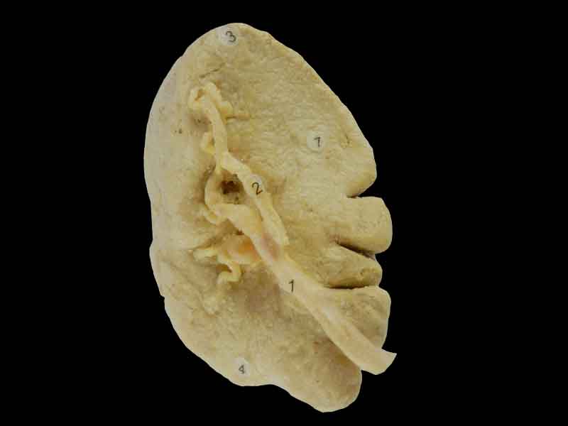 Spleen plastination for sale