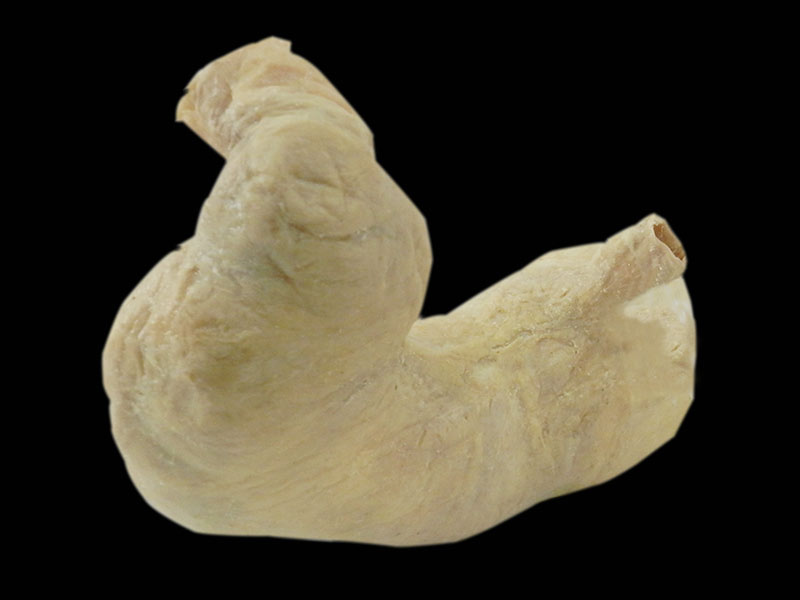 stomach plastinated specimen