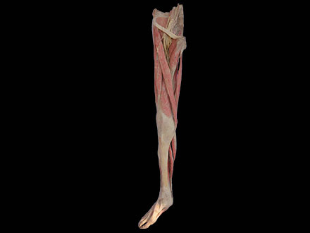 Superficial muscles of lower limb plastinated specimen