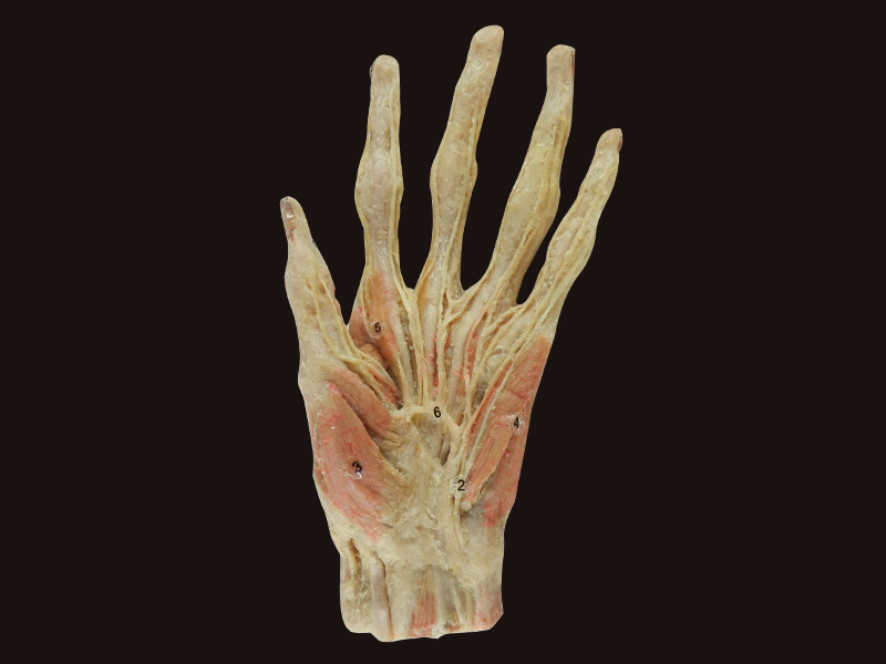 superficial palmar arch