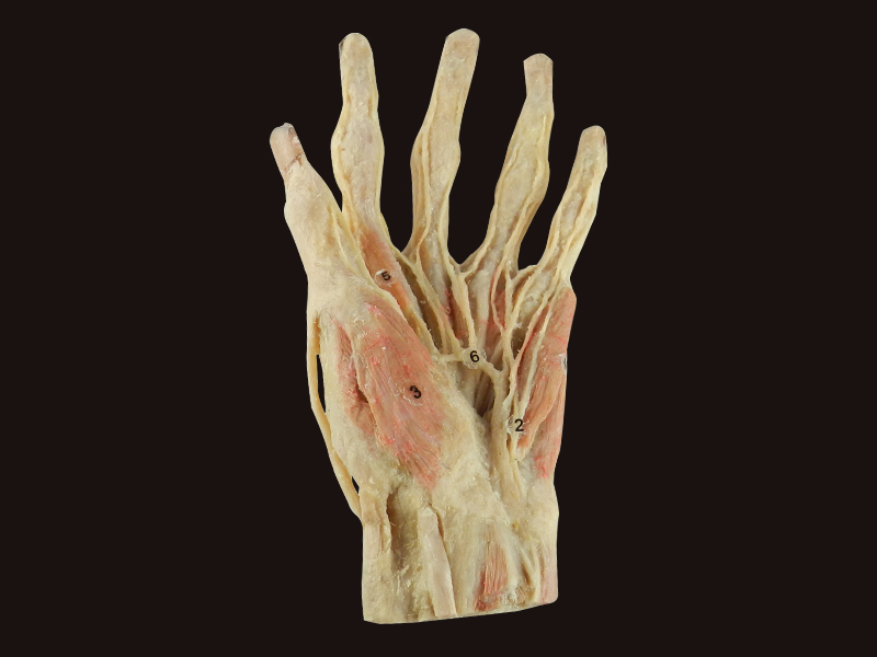 Superficial Palmar Arch Plastinated Specimensanatomy Modelanatomy