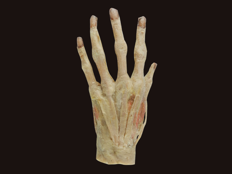 superficial palmar arch plastination for sale