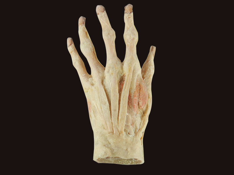 superficial palmar arch plastination specimen