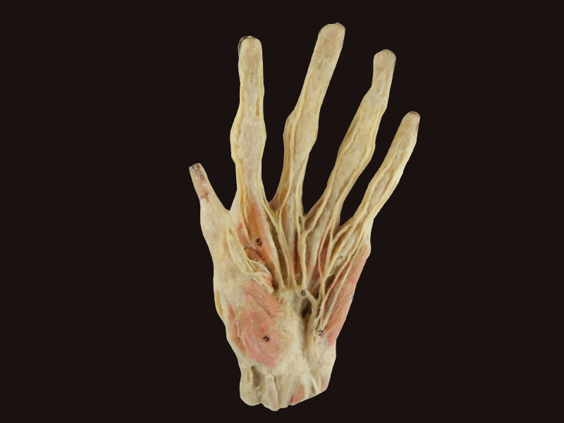 Superficial Palmar Arch Plastinated Specimensanatomy Modelanatomy