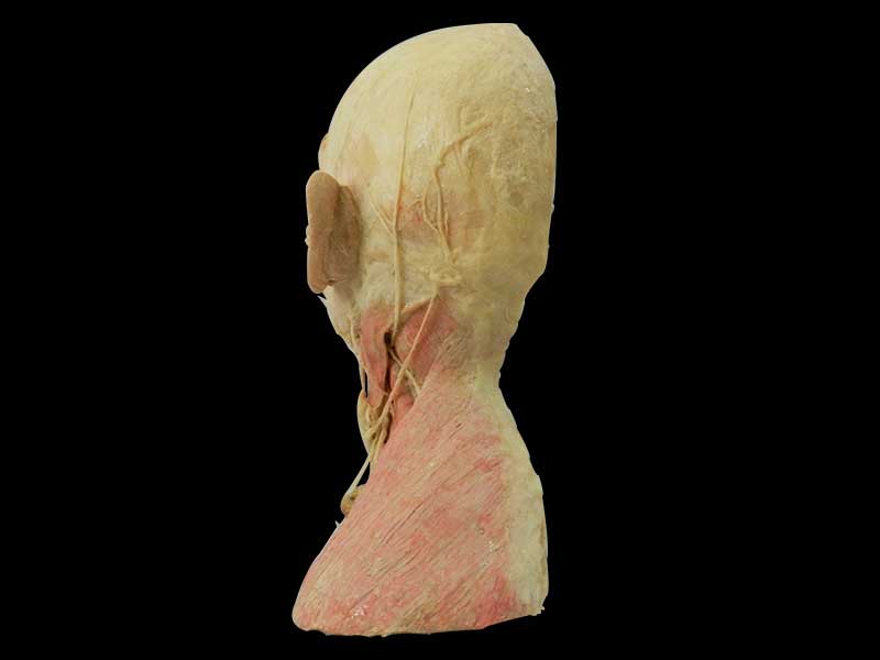 Superficial vascular nerve of head and neck plastinated specimen