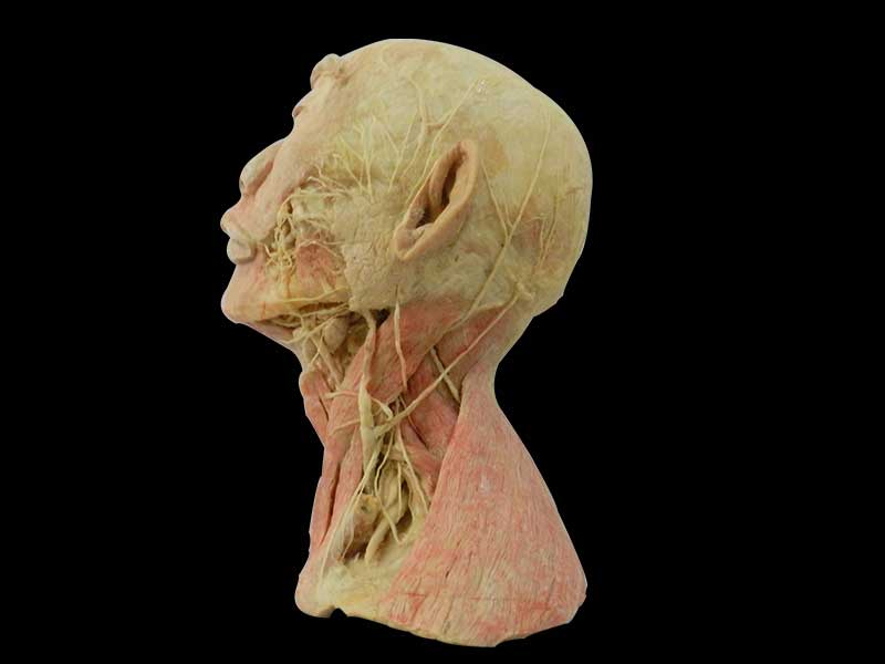 Superficial vascular nerve of head and neck plastination