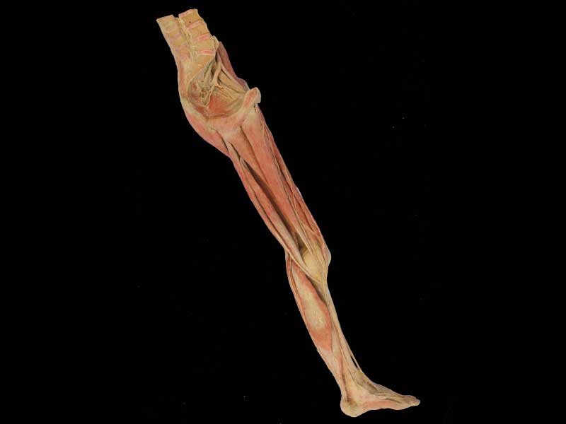 Superficial vein and nerve of lower limb plastinated specimen