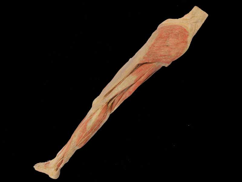 Superficial vein and nerve of lower limb plastination