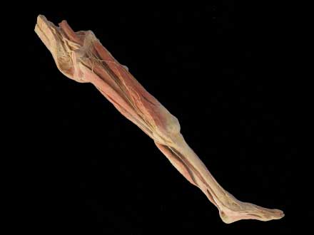 Superficial vein and nerve of lower limb plastination