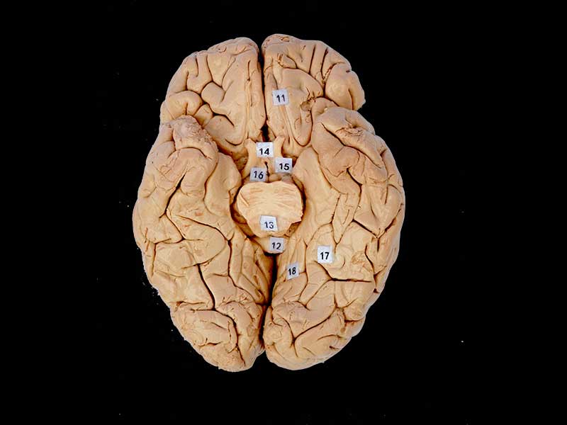 The horizontal section of brain
