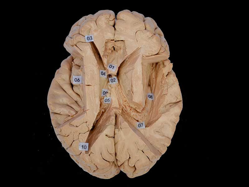 The horizontal section of brain plastinated specimen