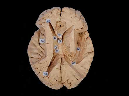 The horizontal section of brain
