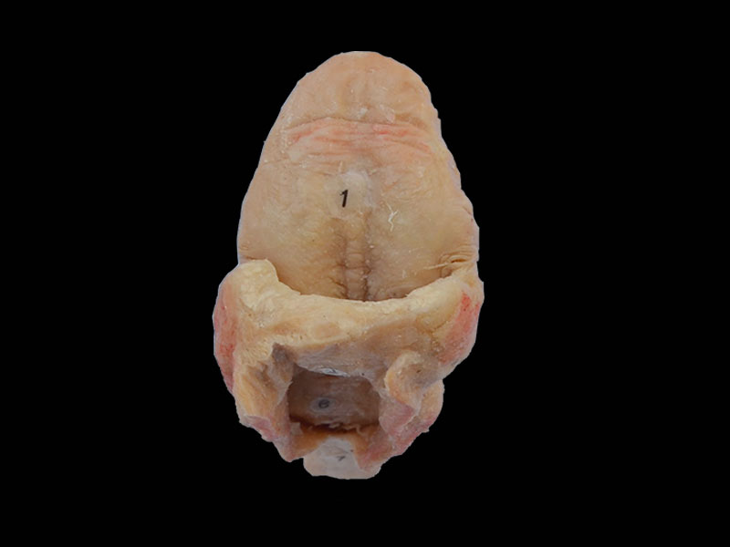 tongue