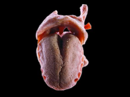 Tongue plastinated specimens (plastinated specimen )