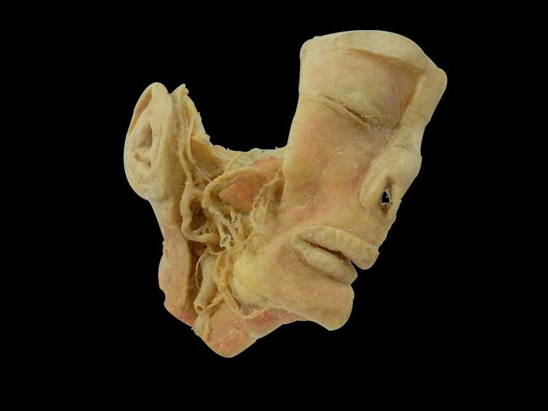 trigeminal nerve plastinated specimen