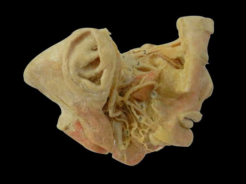 trigeminal nerve plastination