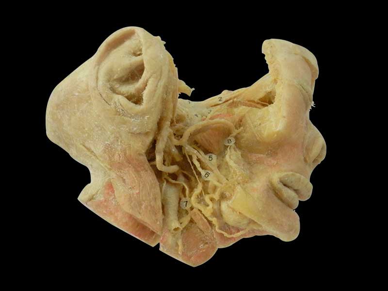 trigeminal nerve
