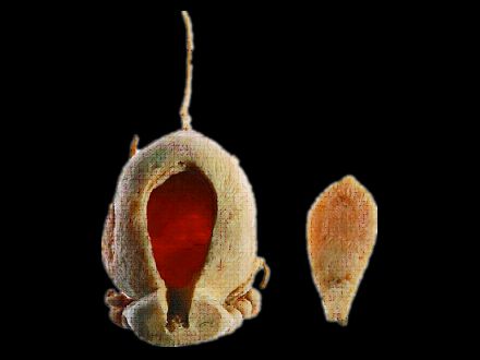 Anterior bladder plastinated specimens