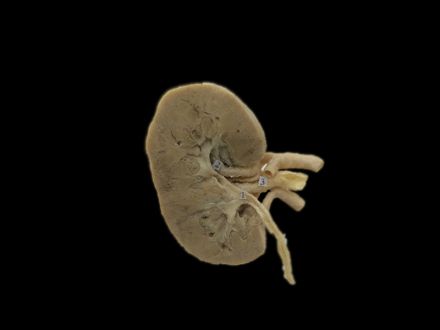 Coronal section of kidney plastinated specimens